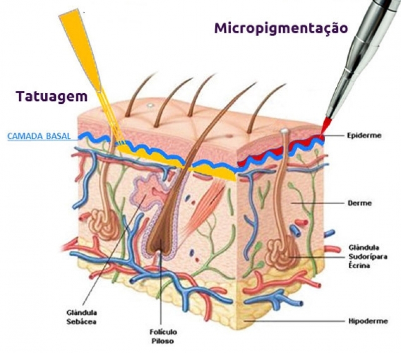 Clínicas de Pigmentação Capilar em Entradas Jardim Paulista - Clínica de Pigmentação Capilar em 3d