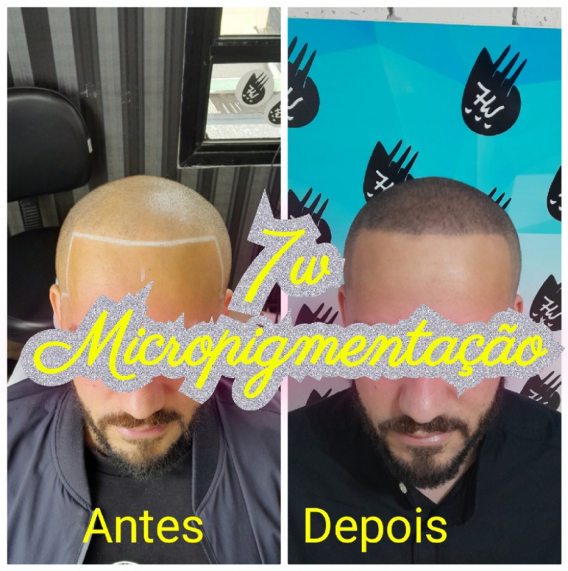 Nano Pigmentação Cabelo Valor Engenheiro Goulart - Nano Pigmentação de Barba ABC Paulista