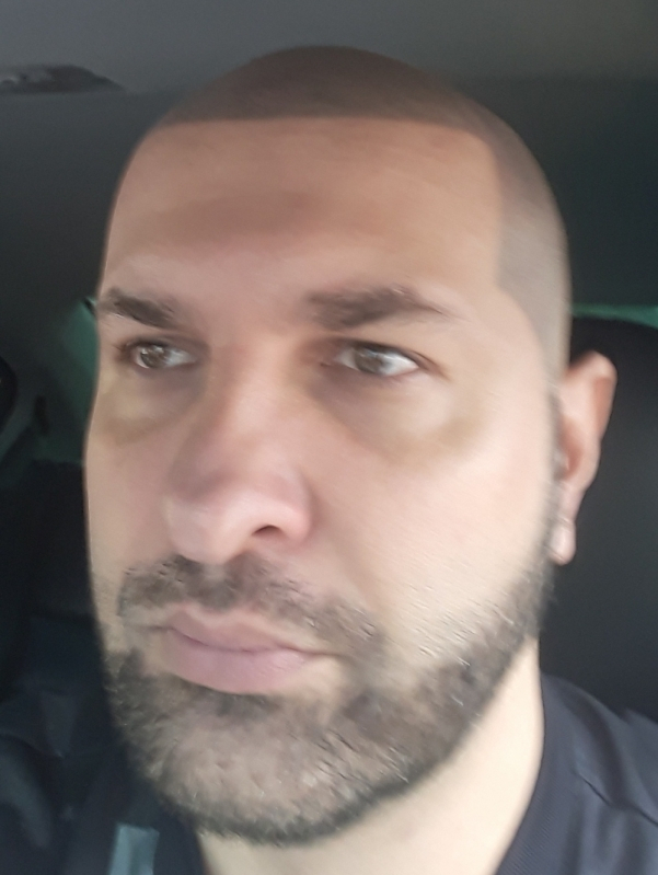 Preço de Micropigmentação em Barba Jardim Iguatemi - Micropigmentação Fio a Fio Barba Santo André