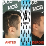 clínica de pigmentação de cabelo masculino Bertioga