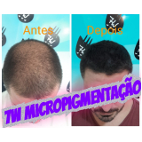 clinica que faz nano pigmentação cabelo Butantã