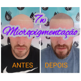 clinica que faz nano pigmentação no cabelo Moema