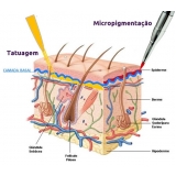 clínicas de pigmentação capilar em entradas Embu das Artes