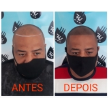 micropigmentação de cabelo agendar São Mateus