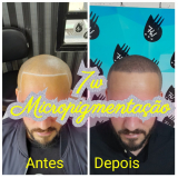 nano pigmentação cabelo valor São Miguel Paulista