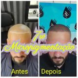 nano pigmentação cabelo valor Pirituba