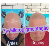 nano pigmentação de barba preço Guarujá