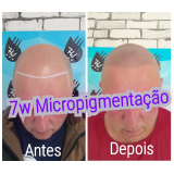 nano pigmentação de barba preço Ferraz de Vasconcelos