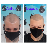 nano pigmentação na barba valor Artur Alvim