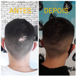 nano pigmentação no cabelo valor Bela Vista