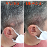 nano pigmentação no cabelo Rio Pequeno