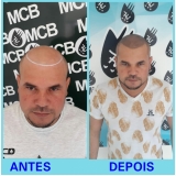 onde encontro clínica de pigmentação capilar Jabaquara