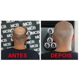 onde encontro clínica de pigmentação de cabelo masculino Aeroporto