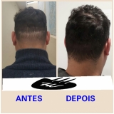 onde encontro pigmentação de cabelo masculino Butantã