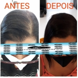 onde fazer micropigmentação capilar cabelo grande Raposo Tavares