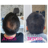 onde fazer nano pigmentação no cabelo Imirim