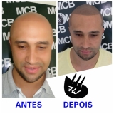 pigmentação de cabelo masculino preço Guarujá