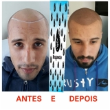 pigmentação de cabelo masculino valor ABC Paulista