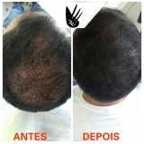 pigmentação de cabelo masculino Vila Leopoldina